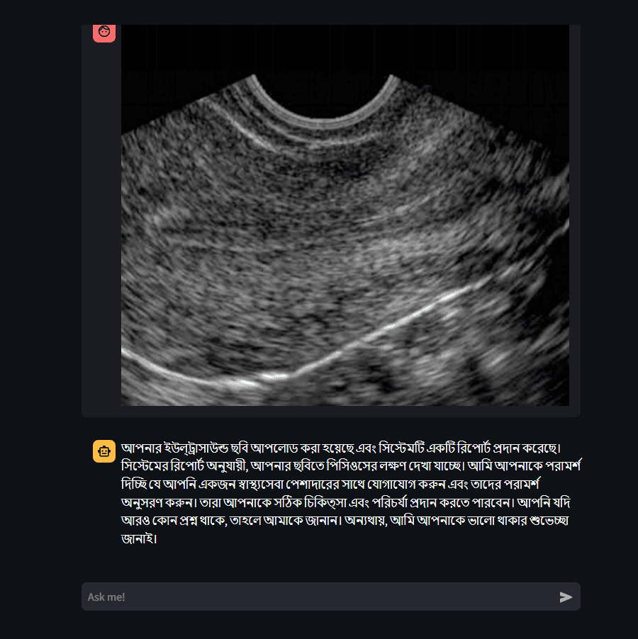 PCOS Chatbot displaying an uploaded ultrasound and Bangla guidance